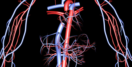 Endovascular Surgery - angioplasty