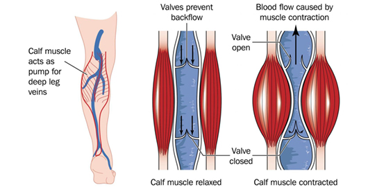 Venous Disease Treatment