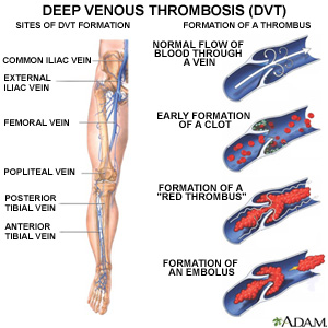 Vascular Surgeon in Pune
