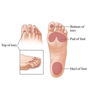 Best Vascular Surgeon in Pune