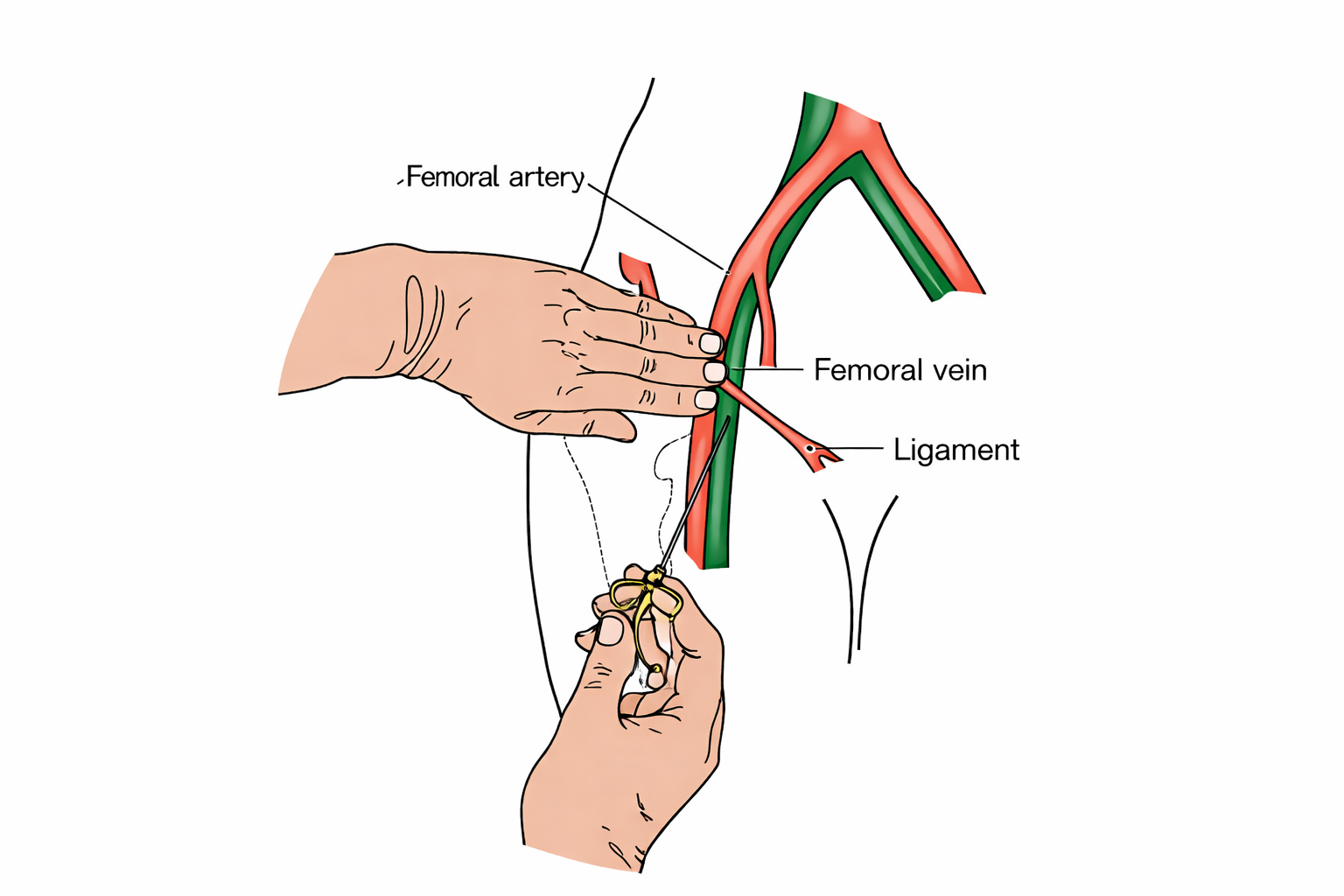 ChatGPT Image Jan 19, 2026, 02_53_50 PM Angiography and Angioplasty procedure by Vascular Surgeon in Pune