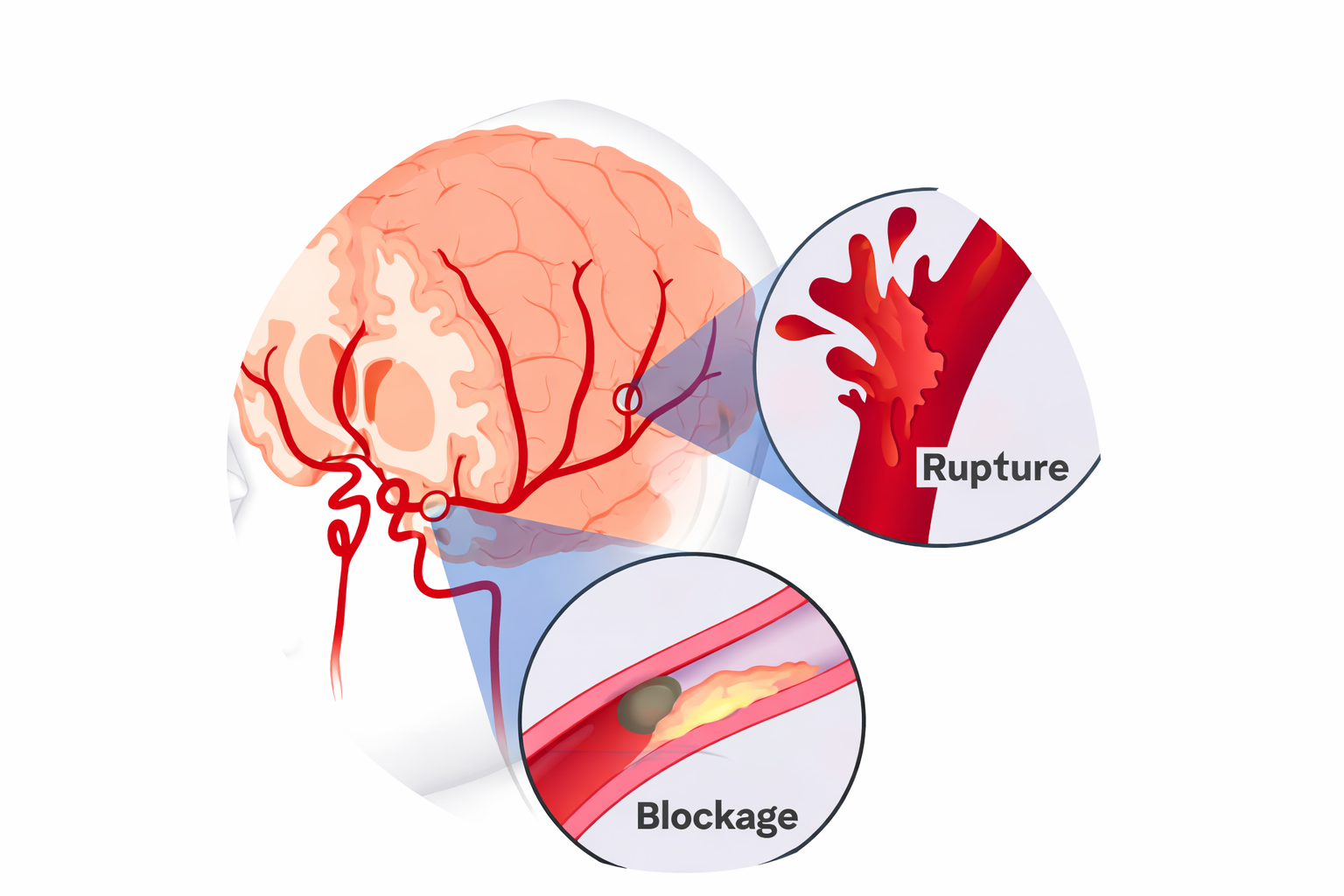 ChatGPT Image Jan 19, 2026, 03_50_25 PM Varicose vein surgery for improved leg circulation